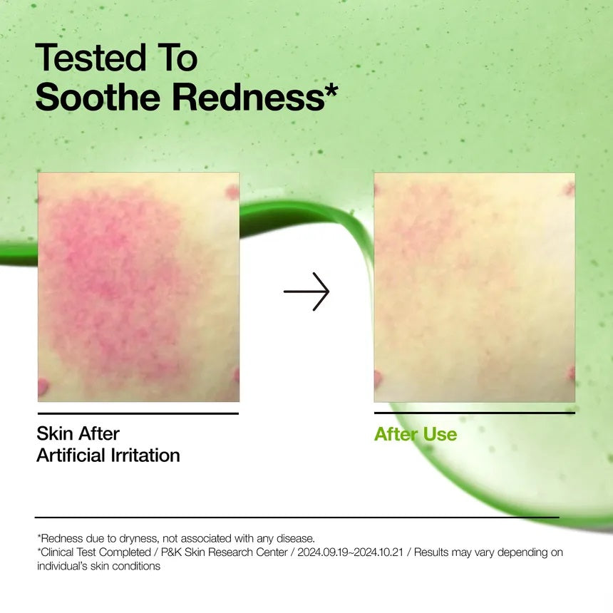 ANUA Azelaic Acid 10 Hyaluron Redness Soothing Serum – 30ml